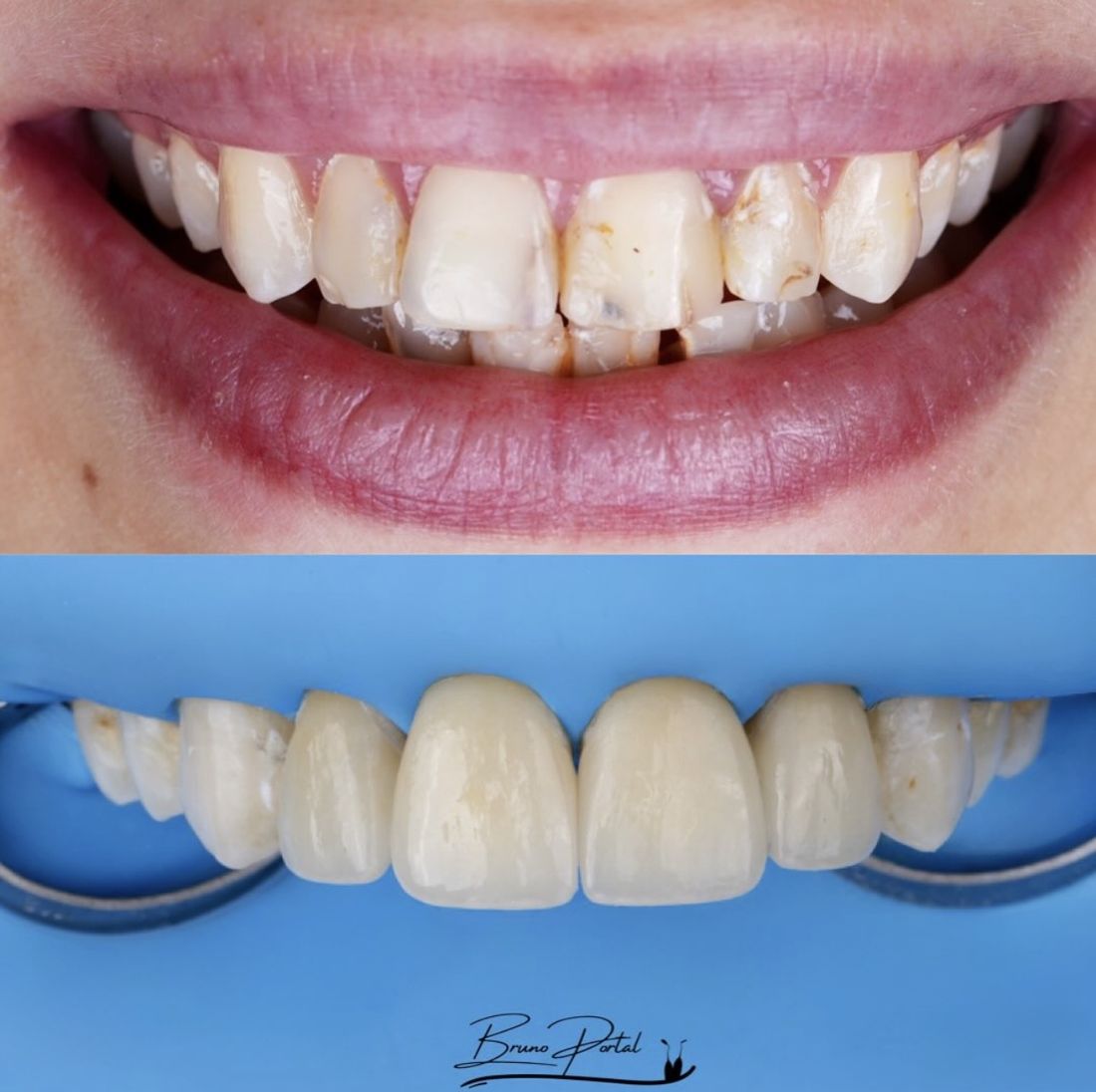 Caso 07: antes e depois