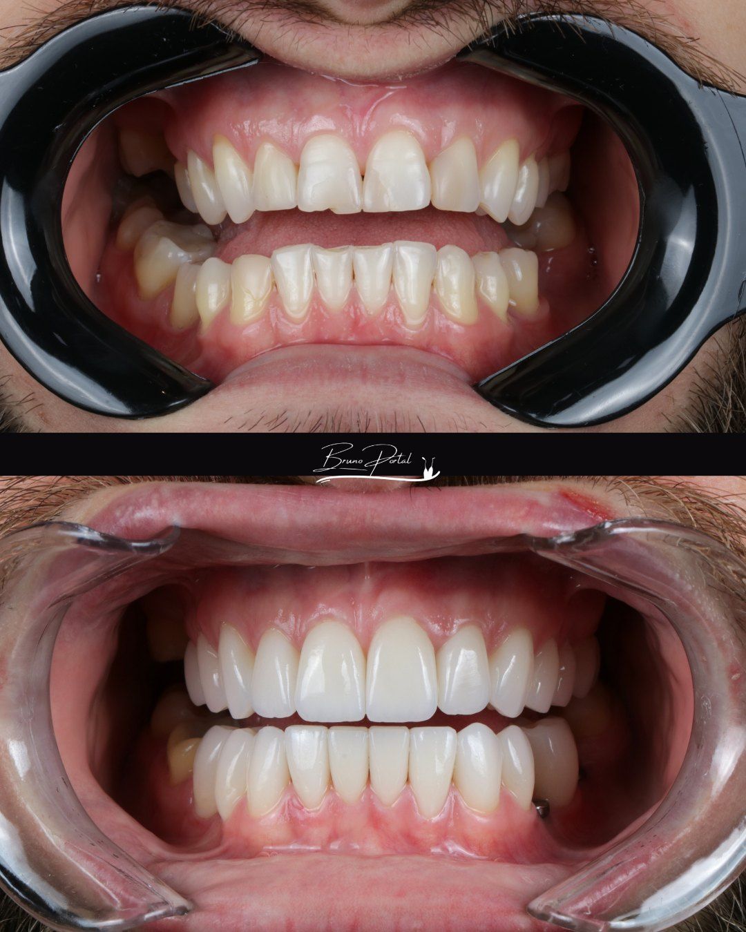 Caso 06: antes e depois